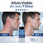 Folliculitis Cream